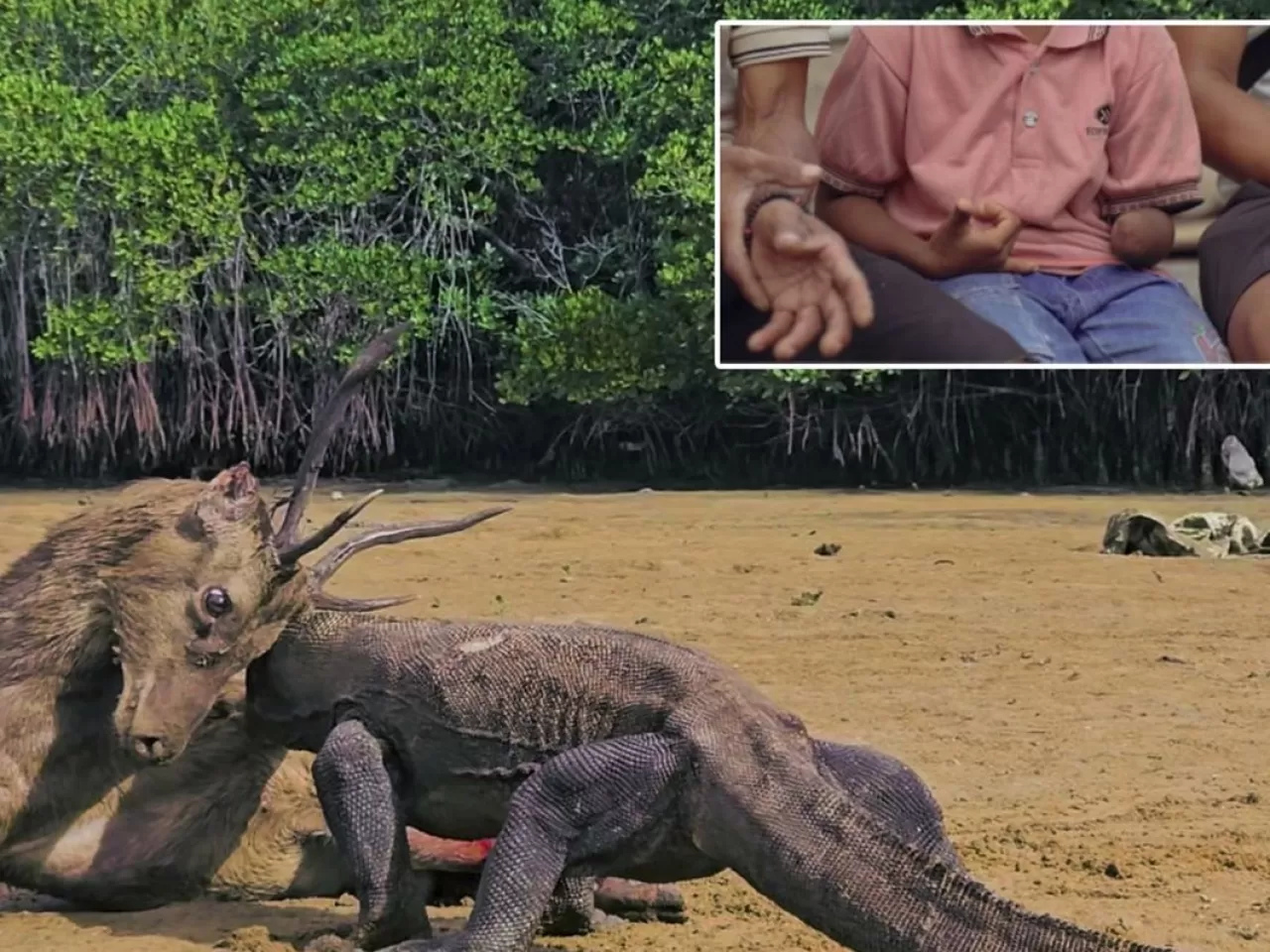 Komodo ejderinin saldırısında kolunu kaybeden çocuk Türkiye'ye nakledilebilir.