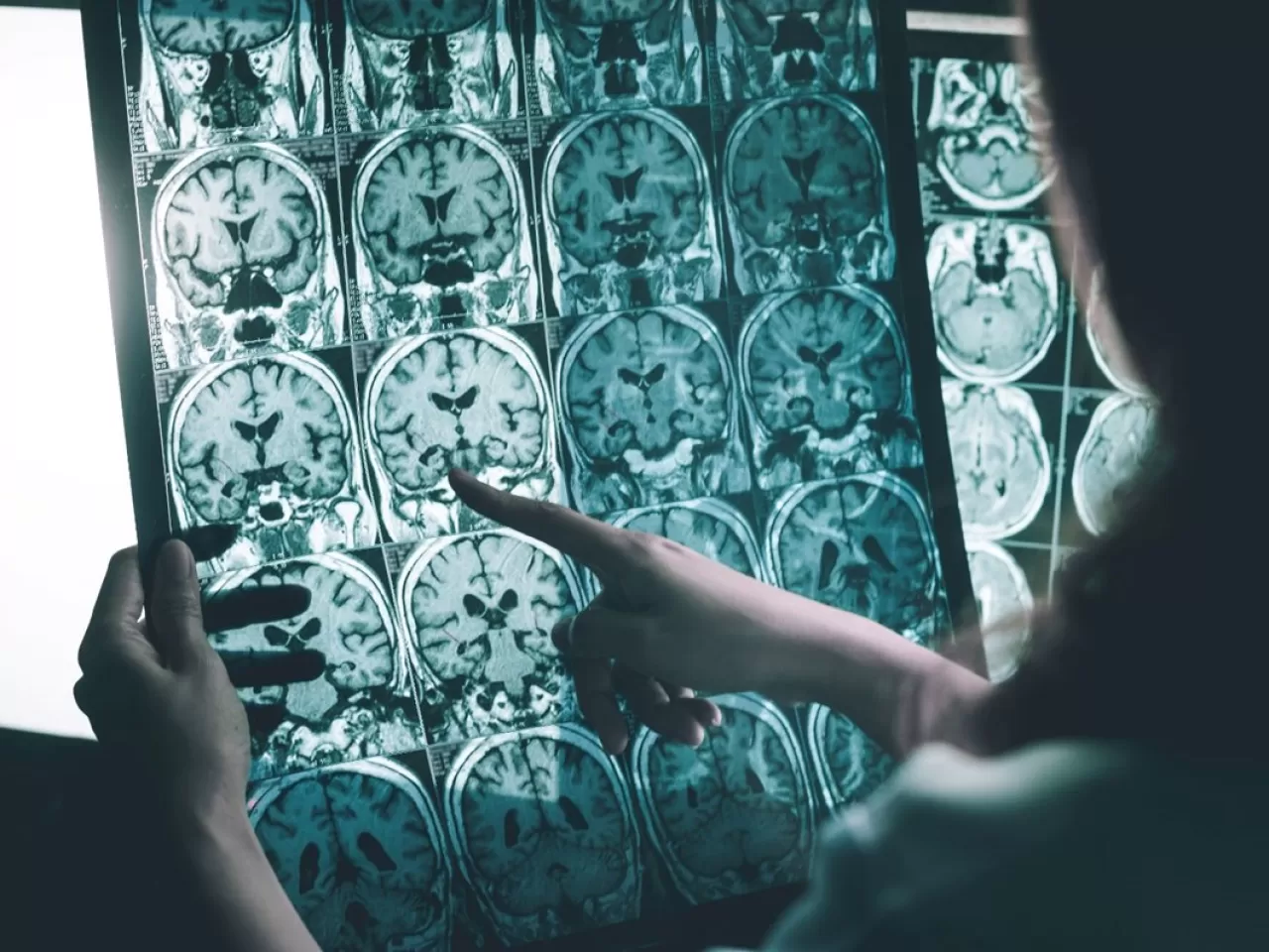 ALS hastası olan bir kişiye beyin implantı takıldıktan sonra mucizevi bir gelişme yaşandı. Artık şarkı söylemeye başlayan hastanın hikayesi şaşırtıyor!