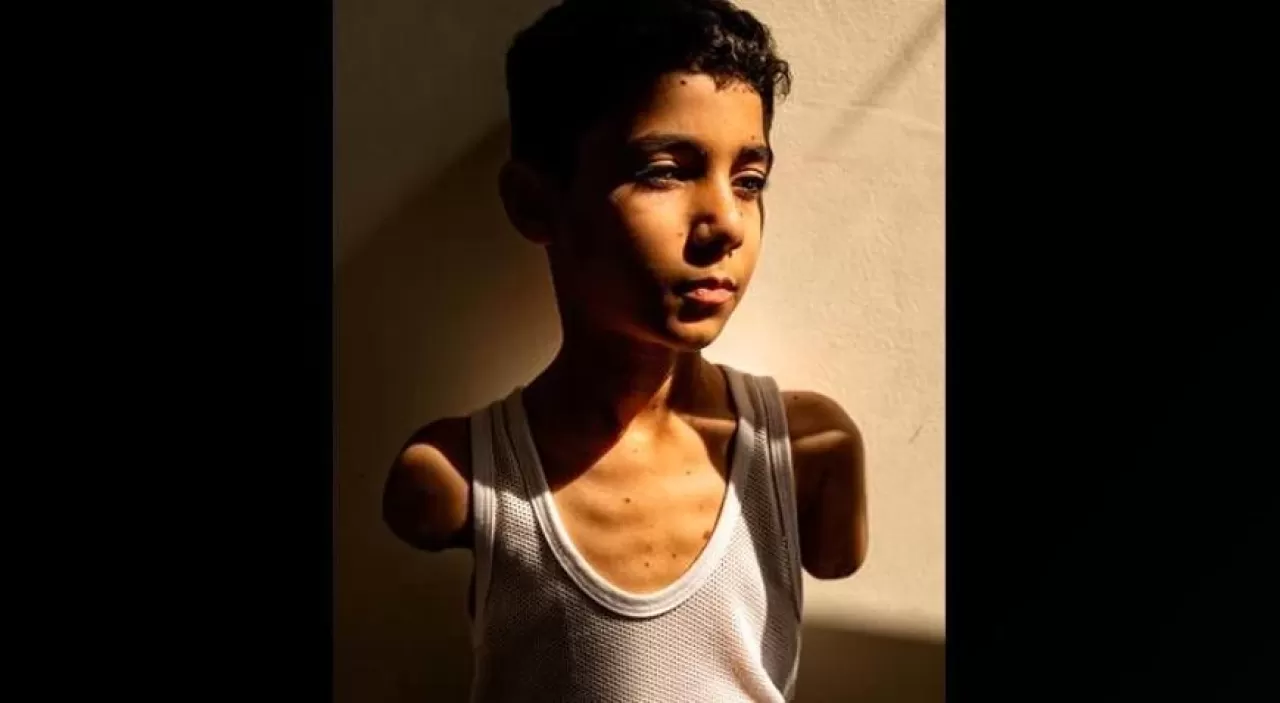 Basın Dünyası Seçimini Yaptı: Yılın Fotoğrafı Yaralı Filistinli Çocuğun Portresi Oldu