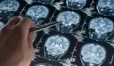 Alzheimer ile Mücadelede Kritik Veri: Hastalığın Patolojik Başlangıç Yaşı Yeniden Tanımlanıyor