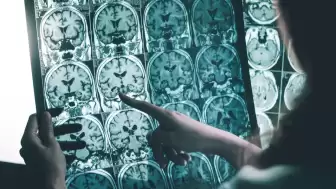 ALS hastası olan bir kişiye beyin implantı takıldıktan sonra mucizevi bir gelişme yaşandı. Artık şarkı söylemeye başlayan hastanın hikayesi şaşırtıyor!