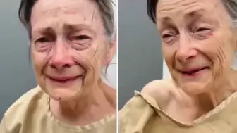 Yurt dışında bir kadın, yüzüne yaptırdığı estetik operasyonu sonrası adeta başka bir insana dönerek gençleşti