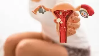 Her 10 Kadından 1’inde Görülen Çikolata Kistine Dair Kritik İkaz: ‘Kader Değil, Hastalığın Habercisi’