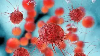 Kanser yaş'a bakmıyor