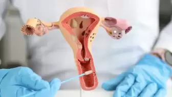 Sessiz tehlike endometriozis: Organ yetmezliği ve kısırlık riskine yol açıyor