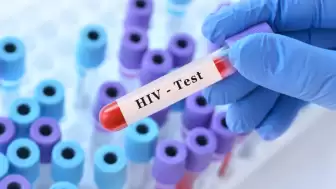 Kemik iliği nakli sayesinde HIV’i yenmeyi başardı!
