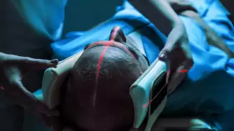 Sağlık sektöründe yapay zeka krizi: 'Radyologlara gerek kalmayabilir'