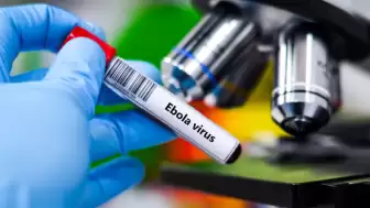 Aşısı ve Tedavisi Yok: Kongo’da Nadir Görülen Ebola Varyantı Yayılıyor