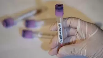 Dünya Sağlık Örgütü’nden hantavirus açıklaması