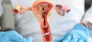 Sessiz tehlike endometriozis: Organ yetmezliği ve kısırlık riskine yol açıyor