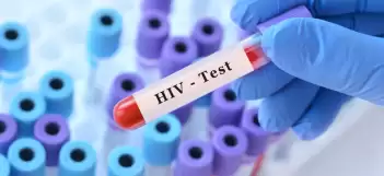 Kemik iliği nakli sayesinde HIV’i yenmeyi başardı!