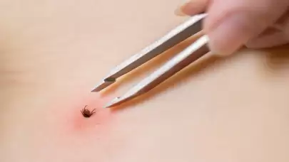 Yüksek sıcaklıkların etkisiyle kene vakalarında yaşanan artış merak konusu oldu: İşte detaylar...