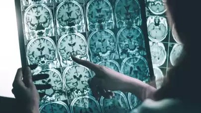 ALS hastası olan bir kişiye beyin implantı takıldıktan sonra mucizevi bir gelişme yaşandı. Artık şarkı söylemeye başlayan hastanın hikayesi şaşırtıyor!