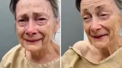 Yurt dışında bir kadın, yüzüne yaptırdığı estetik operasyonu sonrası adeta başka bir insana dönerek gençleşti