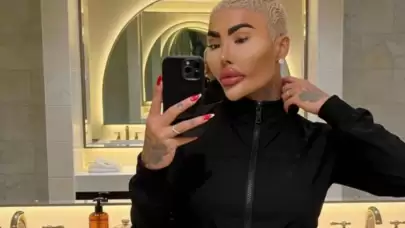 Estetik operasyonlarla Kim Kardashian’a benzemeye çalışan fenomen hayatını kaybetti; olay kapsamında 2 kişi cinayet suçlamasıyla tutuklandı