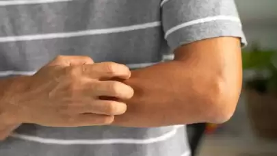 Basit Kaşıntı Ciddi Hastalık Belirtisi Olabilir