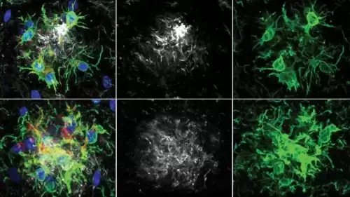 Bilim İnsanlarından Alzheimer’a Karşı Beynin Savunma Sistemini Hedefleyen Yeni Strateji