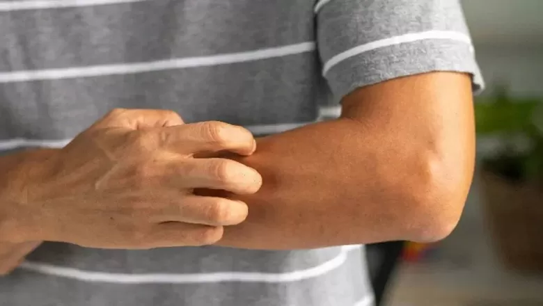 Basit Kaşıntı Ciddi Hastalık Belirtisi Olabilir