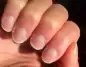 Tırnaklardaki Değişimler Sağlık Sorunlarının Habercisi Olabilir