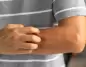 Basit Kaşıntı Ciddi Hastalık Belirtisi Olabilir
