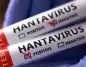 Hantavirüs yeniden gündemde: Uzmanlar kırsal alanlar için uyardı