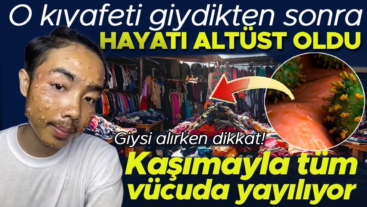 Kıyafet aldı, giydi ve hayatı darmadağın oldu! İşte dikkat edilmesi gereken detaylar!