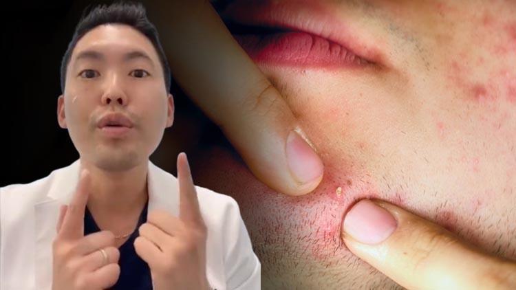 Harvard Mezunu Dermatolog Uyarıyor: Sivilceler ve Lekeler Uzun Süre Kalıyorsa Cilt Kanserinin Habercisi Olabilir