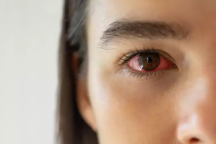 YETERLİ OKSİJEN ALINAMAMASI SONU OLUŞUYOR