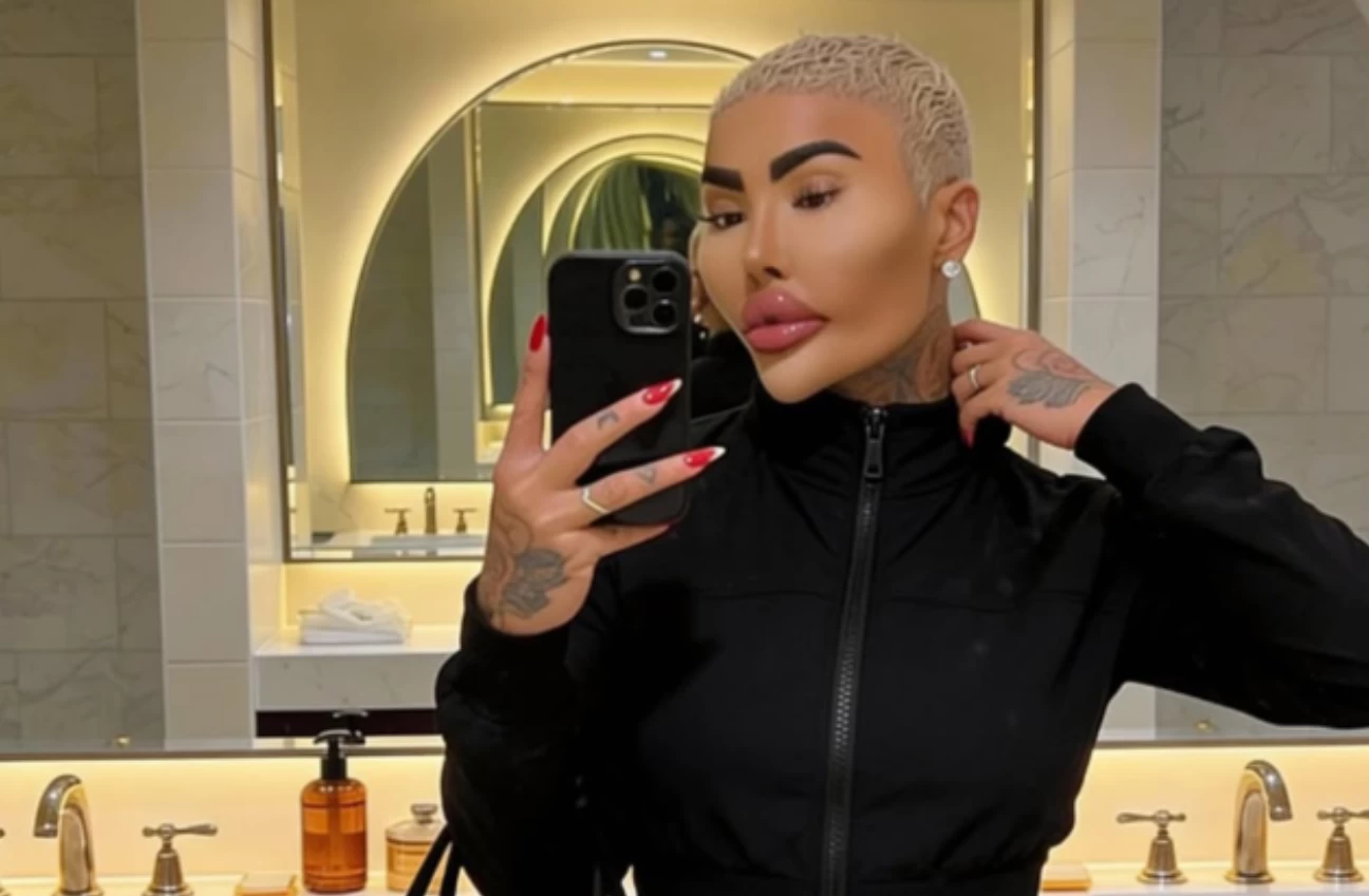 Estetik operasyonlarla Kim Kardashian’a benzemeye çalışan fenomen hayatını kaybetti; olay kapsamında 2 kişi cinayet suçlamasıyla tutuklandı