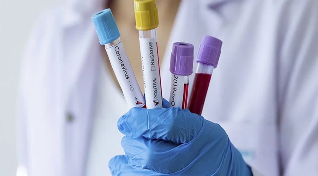 Dünyanın ilk monoklonal antikor hepatit D tedavisi Çin'de uygulanmaya başlandı