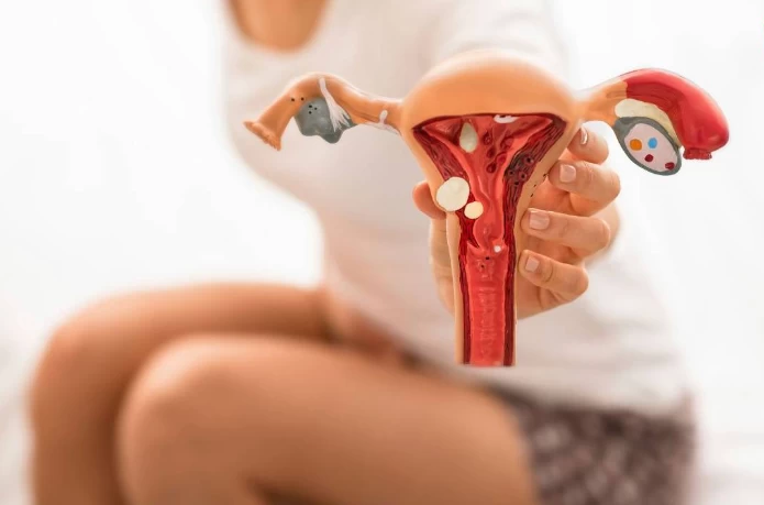 Her 10 Kadından 1’inde Görülen Çikolata Kistine Dair Kritik İkaz: ‘Kader Değil, Hastalığın Habercisi’