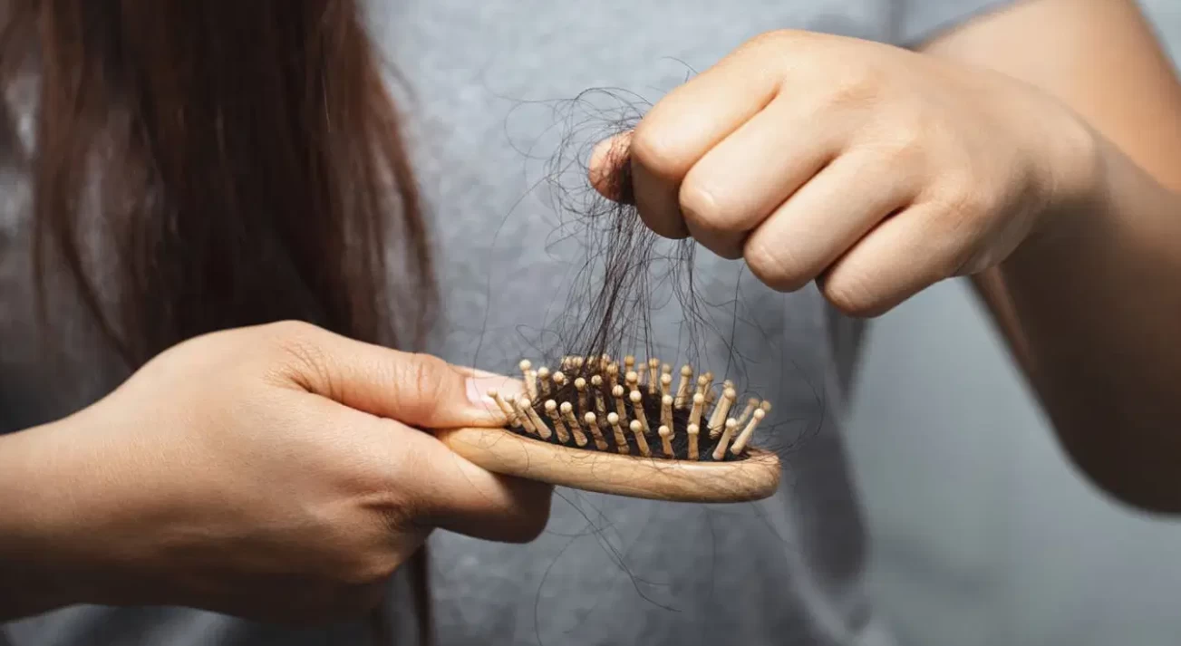 Günde Kaç Tel Normal? Saç Dökülmesinde Kritik Sınır ve Nedenleri