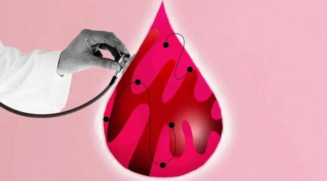 Laparoskopiye Son: Endometriozis Teşhisinde Yeni Nesil Yöntem