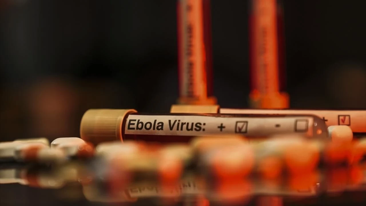 Ebola ile mücadelede finansman krizi endişe yarattı
